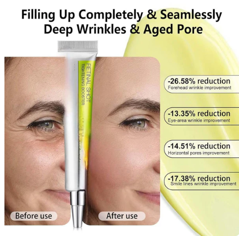 Celimax the Vita A Cream Retinal Shot Tightening Booster 15mL BUY 1 GET 1 FREE 😍